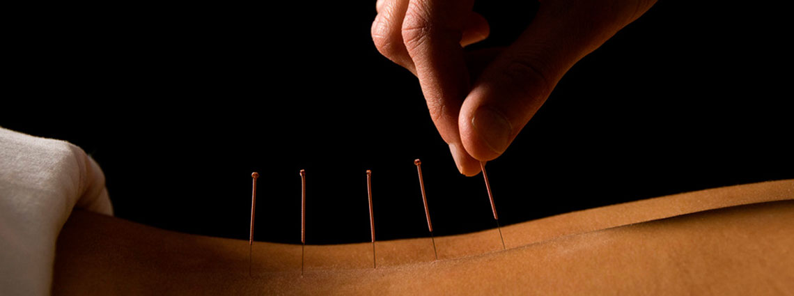 IVF acupuncture support Watford